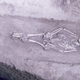 The 5,000-year-old skeleton, designated M53, with physical dysplasia.